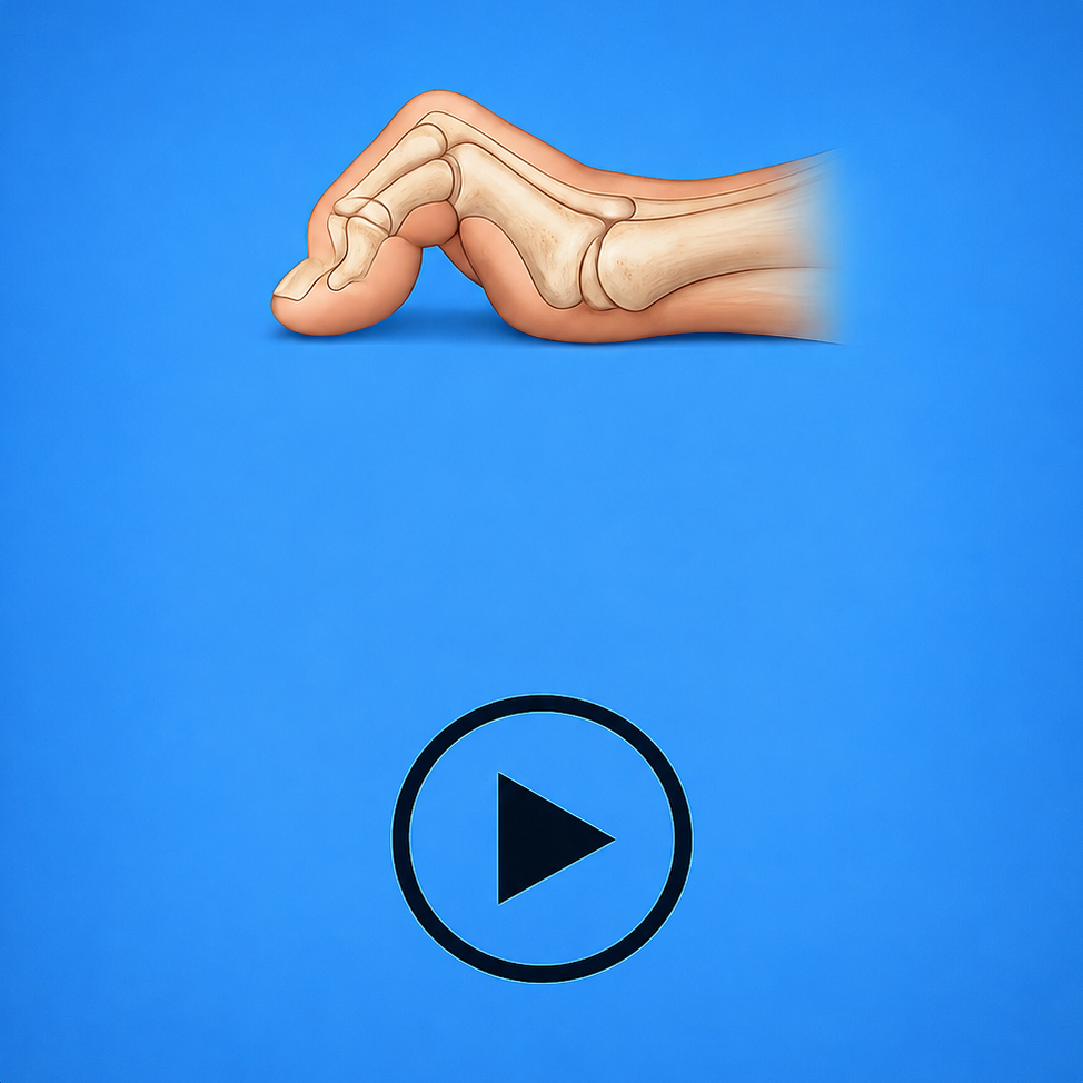 Video: Minimally Invasive Hammertoe Correction